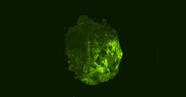 A new virtual reality simulation built by Cambridge University scientists gives a high-resolution detail view into the cells of a breast cancer tumor.
