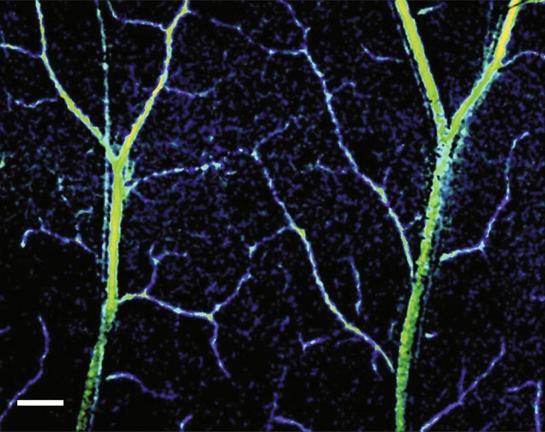 Researchers have developed a new tool which offers an unprecident look, like this image, of the internal structures of human capillaries