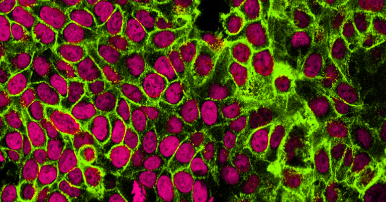 Israeli pharmaceutical company Accelerated Evolution Biotechnologies claims it is working on a cancer cure that will be ready within a year.