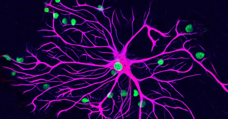 Researchers have found that cells that naturally help fight the inflammation caused by multiple sclerosis originate in the gut.