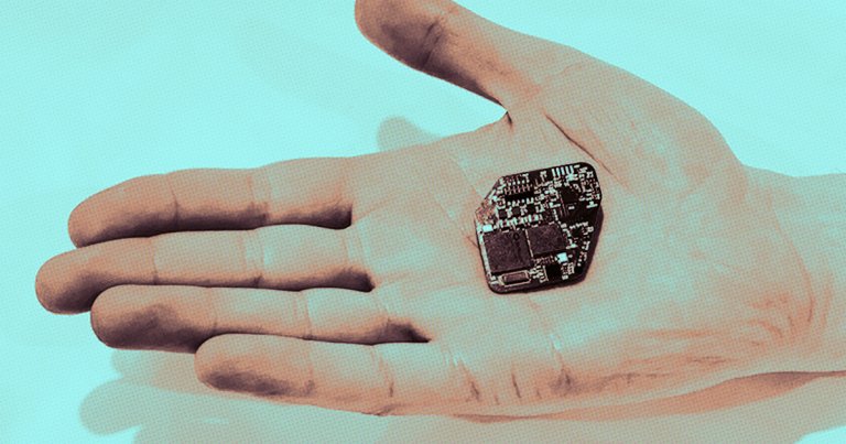 A Wireless Neural Implant Might Jolt the Brain out of Seizures