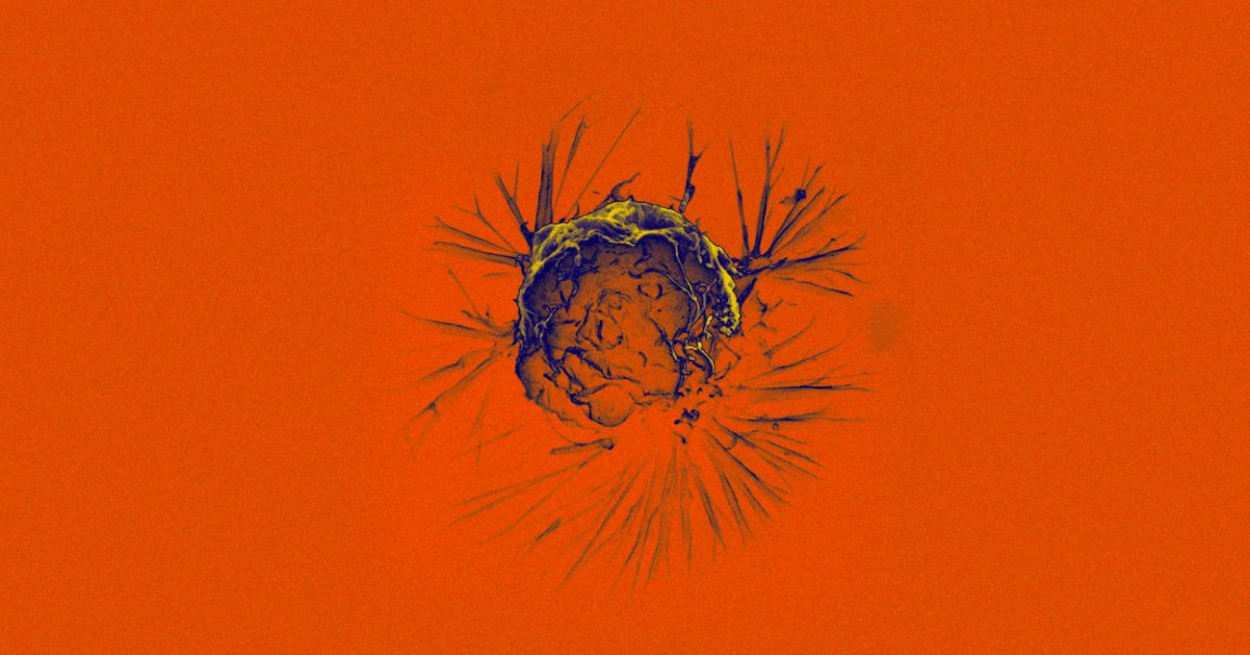 Researchers have discovered what they're calling the cancer "cell of origin," a type of stem cell that leads to the growth of all cancers.