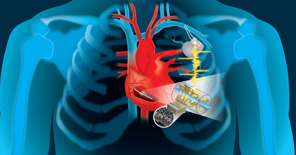 Cyborg Injection New Implant Powers Cyborg Devices Using Your Heartbeat