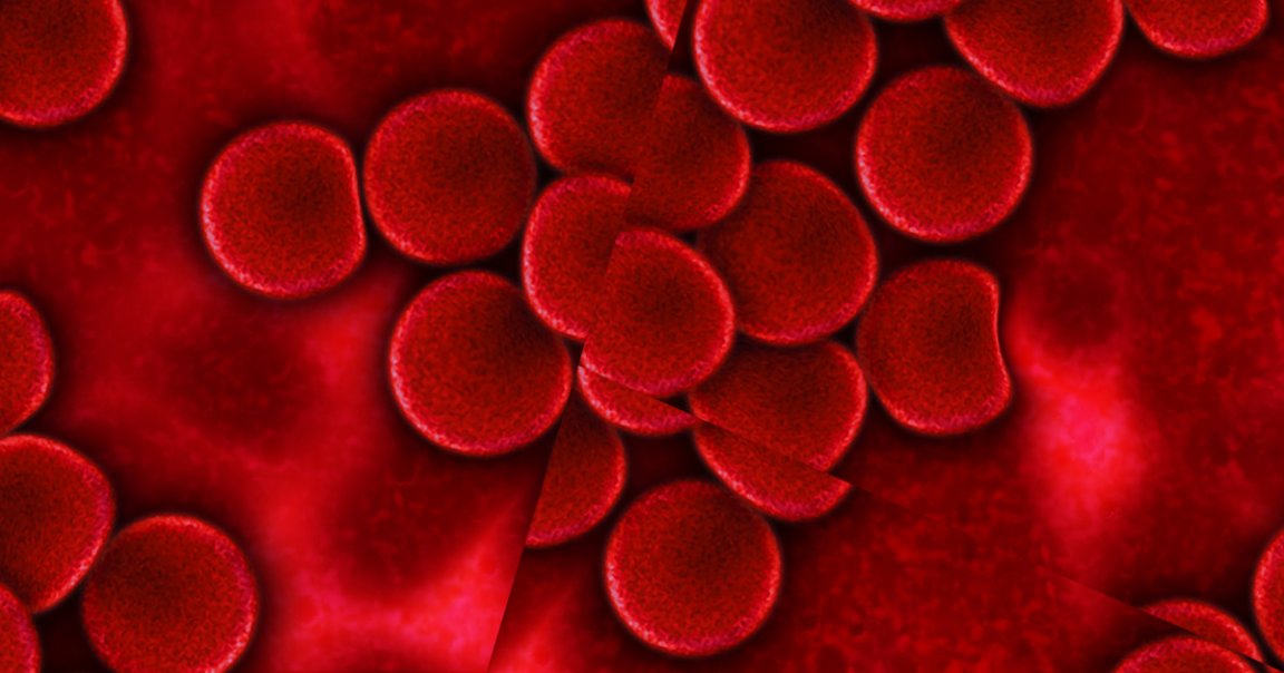 For the first time outside of China, a clinic is using CRISPR gene editing techniques to treat someone in a clinical trial.