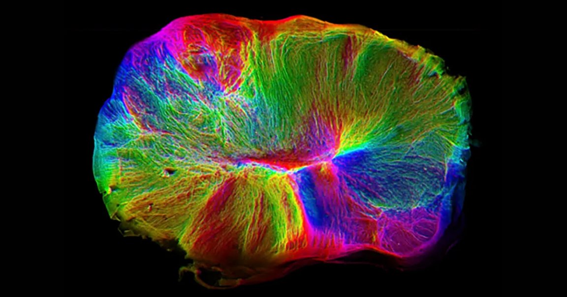 Scientists at Cambridge University say they've grown a miniature brain in a petri dish that seizes control of nearby spinal cords around it.