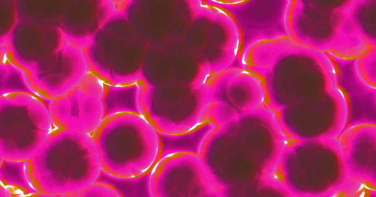 A "super fungus" called Candida auris is cropping up in hospitals all across the globe, killing half the people who contract it within 90 days.