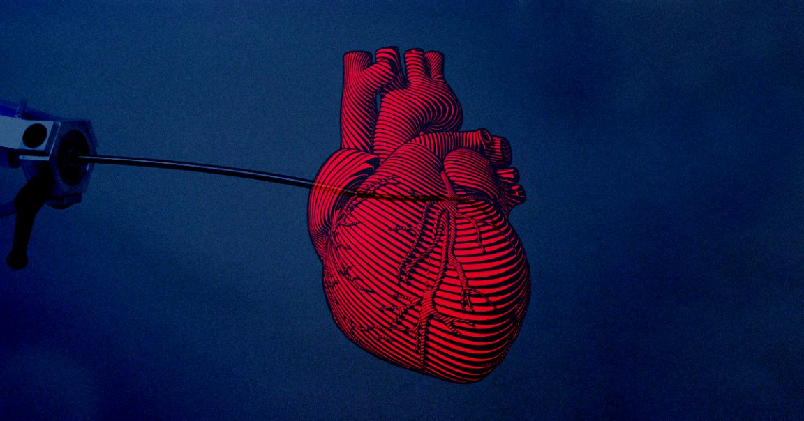 Surgeons just used the first autonomous surgery robot, a self-guiding catheter that could navigate its way through a pig's heart.