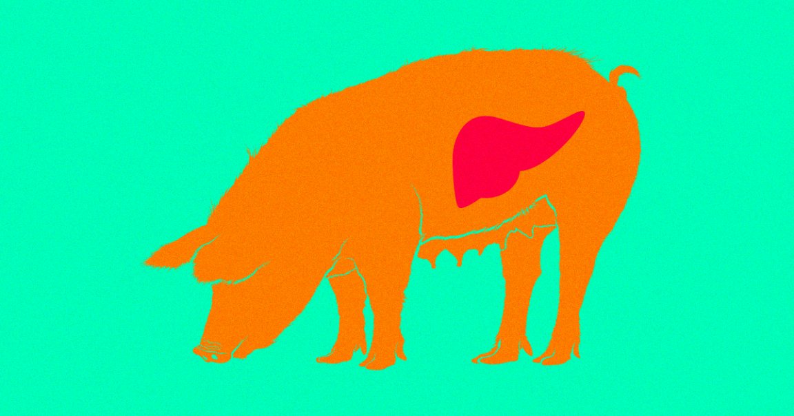 The organ shortage could get worse with the advent of self-driving cars, but advances in xenotransplantation could make up the difference and then some.