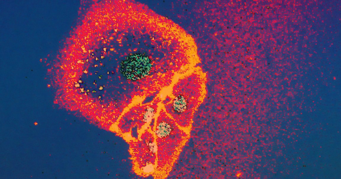 Using CRISPR gene editing tools, MIT scientists turned a human cell into a tiny computer that could be used to detect diseases and churn out treatments.