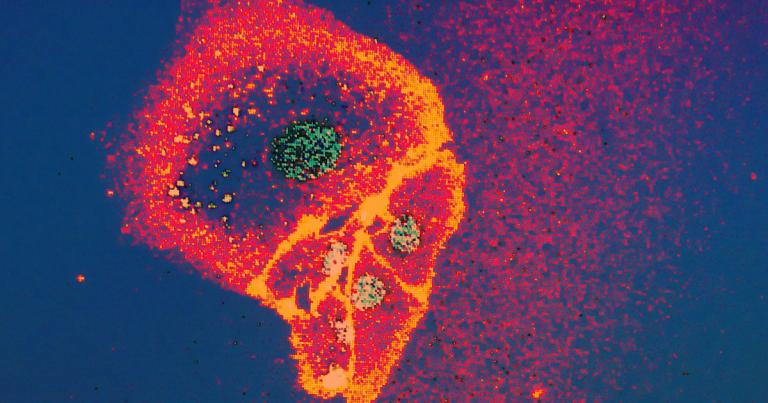 Using CRISPR gene editing tools, MIT scientists turned a human cell into a tiny computer that could be used to detect diseases and churn out treatments.