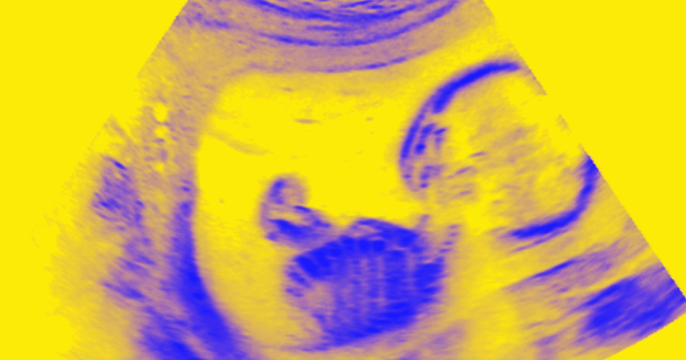 The next gene-hacked human is due to be born next month, and scientists are trying to sort out what that means for the future of humanity.