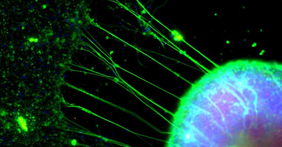 Science writer Philip Ball donated some arm flesh to a lab that grew a miniature brain out of his cells. It made him question how we define humanity.