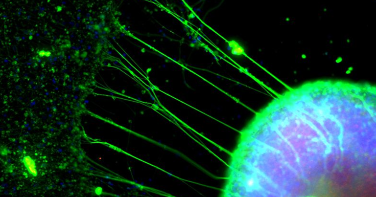 Science writer Philip Ball donated some arm flesh to a lab that grew a miniature brain out of his cells. It made him question how we define humanity.