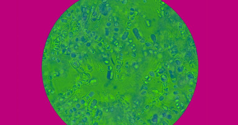 A new study suggests that C. auris evolved the ability to infect and kill humans thanks to climate change, specifically rising global temperatures.