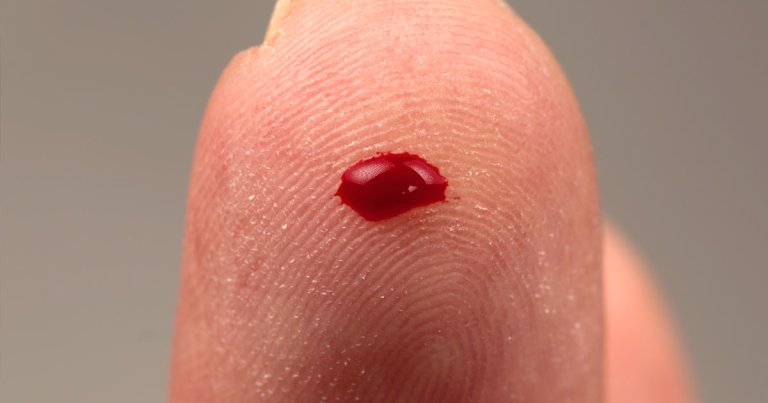 A new blood test that looks at just 14 biomarkers could one day allow doctors to predict the likelihood you're going to die within five to 10 years.