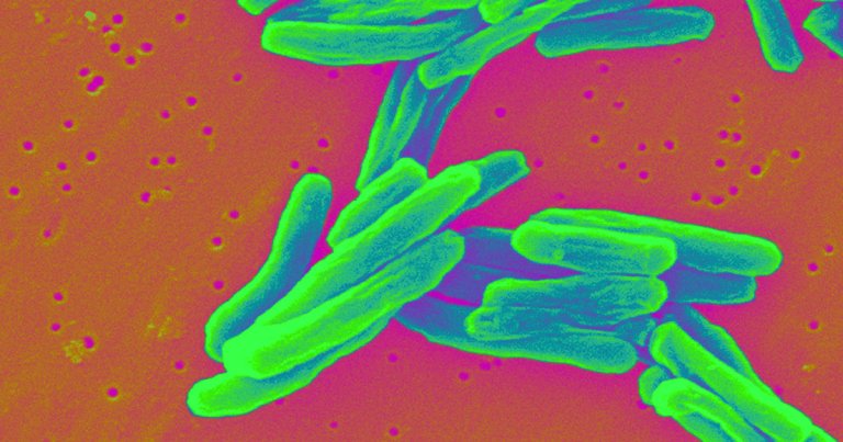 Scientists found a less intensive, more effective cure against the most dangerous strain of tuberculosis, which infects 10 million every year.