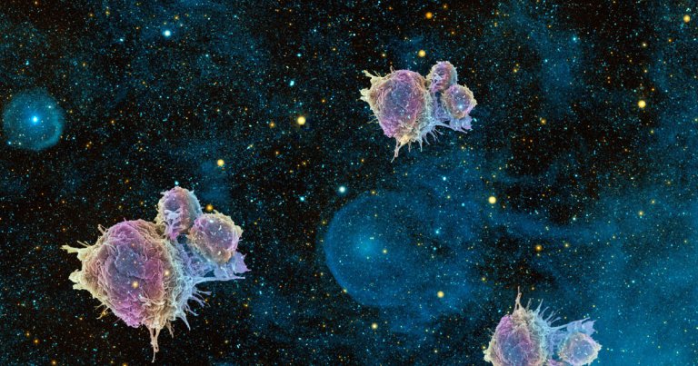 After finding that simulated zero gravity killed off cancer cells, a team of doctors wants to send samples up to the International Space Station.