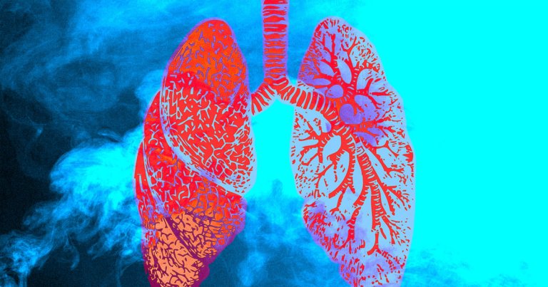 Doctors examining sufferers of the deadly vape lung sickness sweeping the U.S. have identified a rare type of cell in the patients' lungs.