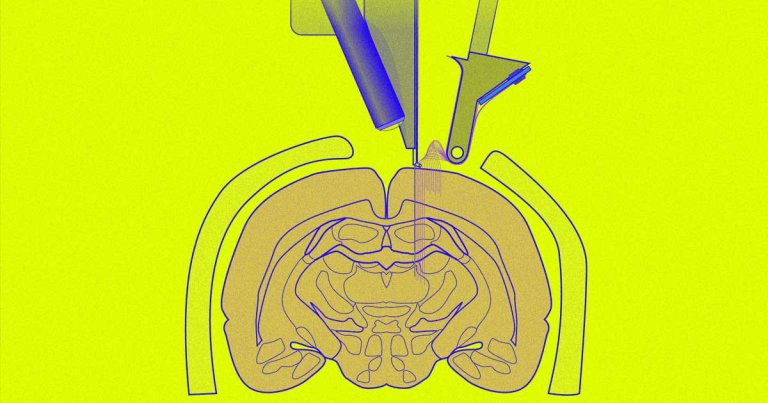 Elon Musk recently claimed that Neuralink tech would be able to "cure" autism, along with schizophrenia. But autism isn't a brain disease that needs a cure.
