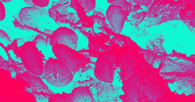 Doctors are treating two people in China for an outbreak of the pneumonic plague, the most serious form of the infamous Black Death disease.