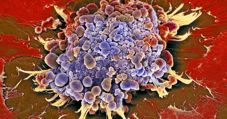 A new cancer drug cuts off tumor cells' food supply while also seemingly supercharging the immune systems' cancer-destroying T cells.