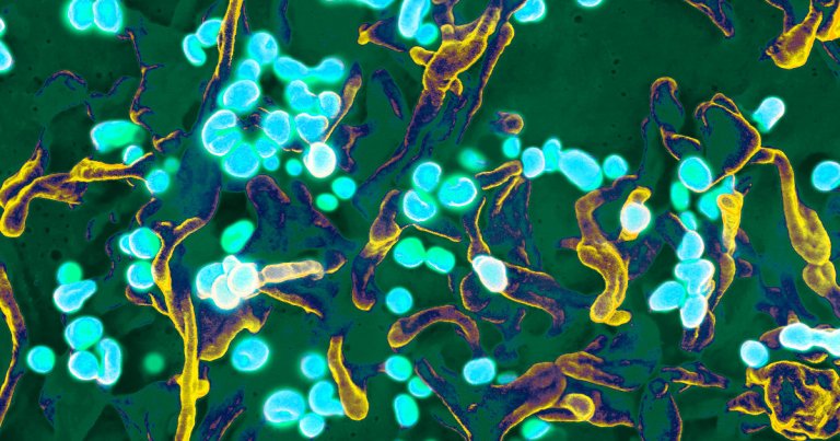 A breakdown of who is getting sick and dying from the coronavirus outbreak shows that elderly people and those who were already sick are getting hit harder.