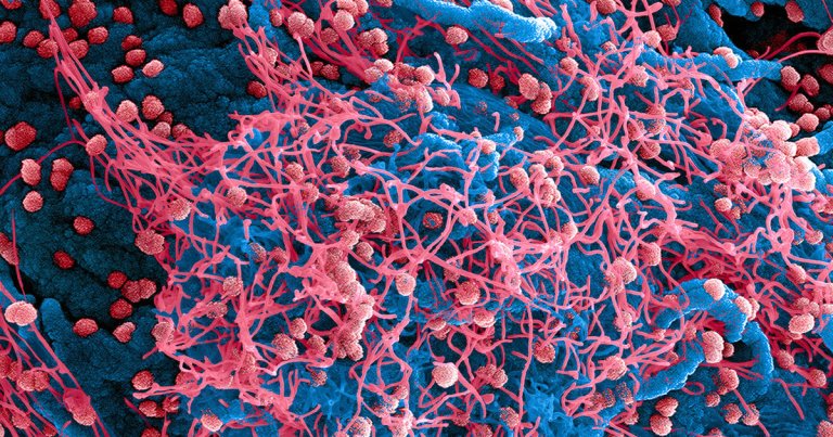 The number of people infected by the coronavirus — and dying from it — is quickly increasing, but has the outbreak reached the level of a pandemic?