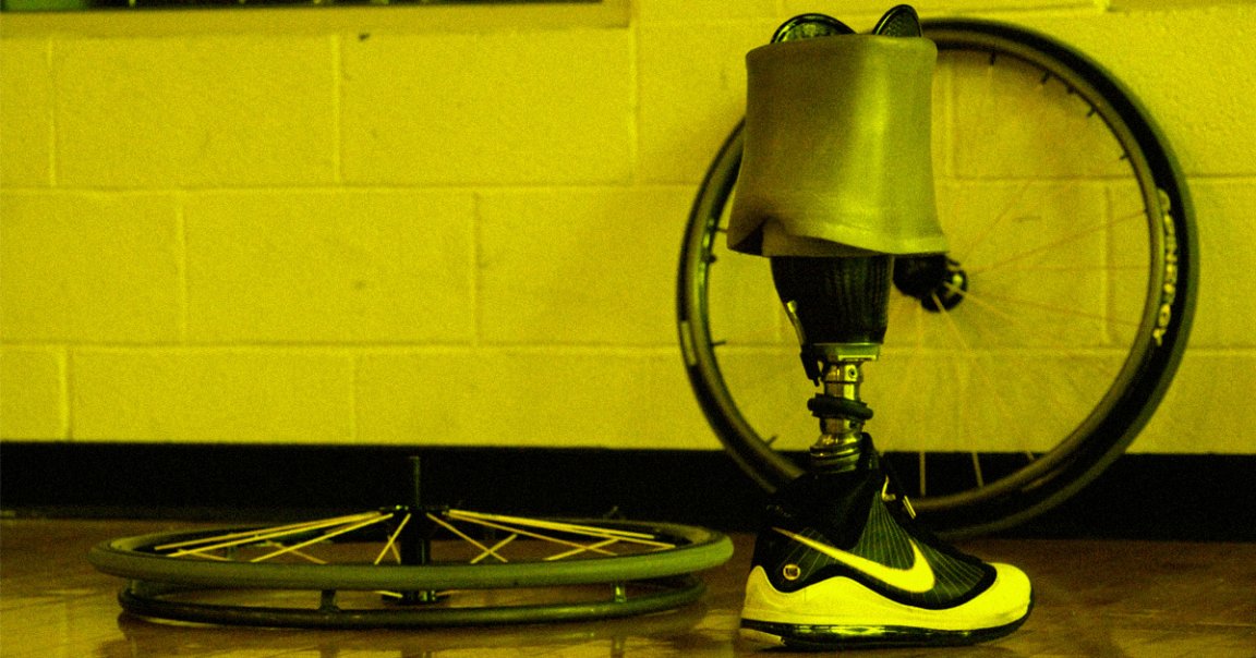 When the Department of Veterans Affairs refused to pay for a disabled veteran's prosthetic legs, the company that provided the limbs came to repo them.