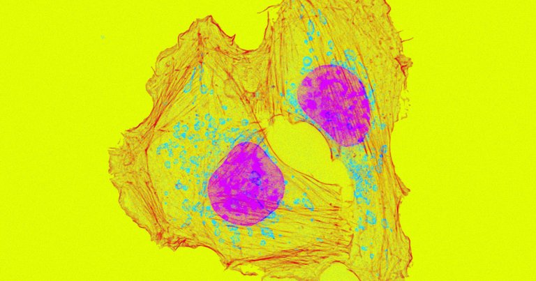 New research reveals that cancer-linked mutations can occur years before any symptoms appear, potentially giving doctors a new tool to diagnose it early.
