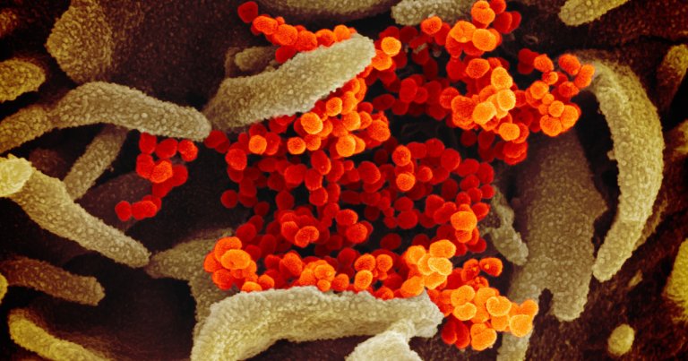 Researchers have released a gallery of stunning images of what the Coronavirus looks like taken with scanning and transmission electron microscopes.