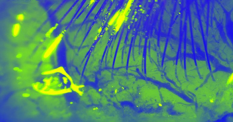 Elon Musk revealed that his secretive brain-computer interface startup Neuralink is working on an "awesome" new version of the company's prototype.
