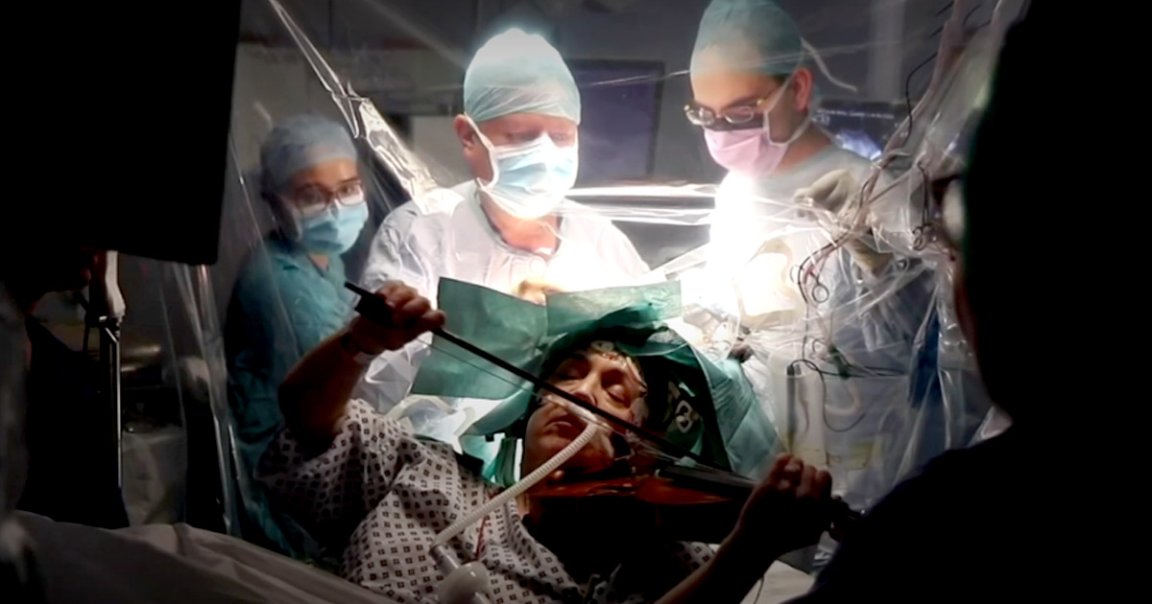 Here's why surgeons kept a talented musician awake and playing violin while they performed surgery on a portion of her brain.