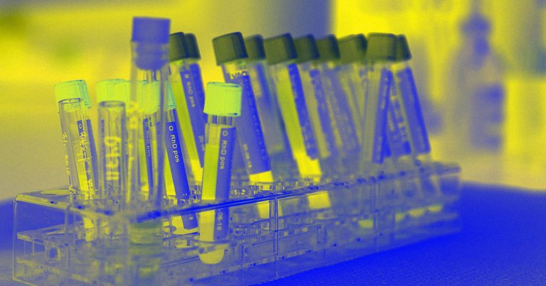 Research teams around the world are trying to develop blood tests for the coronavirus, but so far no one has figured it out.