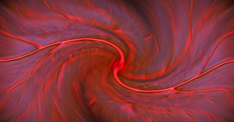 An international team of researchers say that the coronavirus doesn't just attack lungs — it also assaults blood vessels throughout the body.