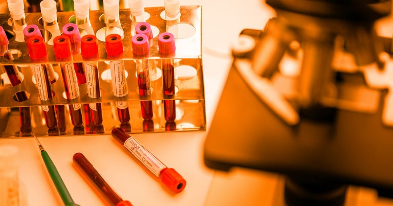 As various teams race to develop a vaccine for the coronavirus, one group at Oxford University says that, under the right conditions, theirs could be available as soon as September.