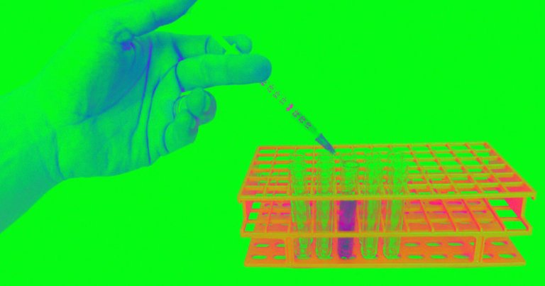 A number of US companies are already selling tests that can detect the presence of COVID-19 fighting antibodies in a patient's bloodstream.