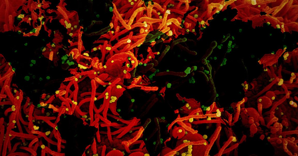 New genetic analysis suggests that COVID-19 spread to the U.S. and Europe weeks or even months earlier than official reports say.