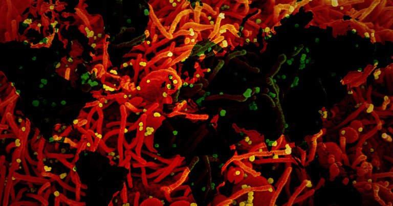 New genetic analysis suggests that COVID-19 spread to the U.S. and Europe weeks or even months earlier than official reports say.