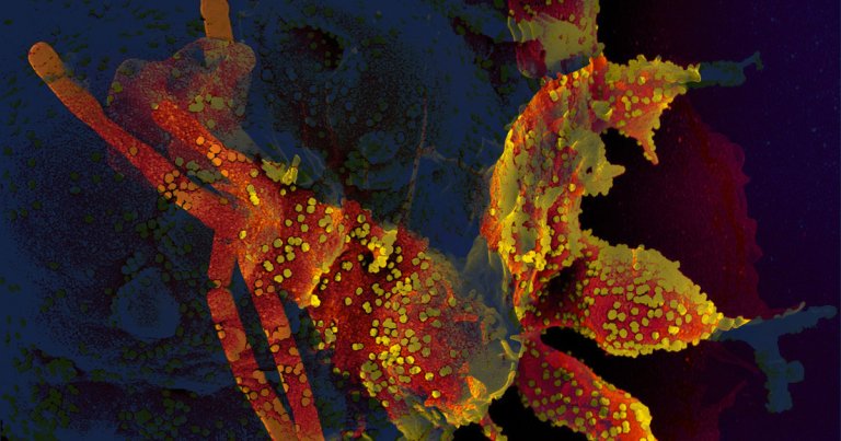 A new study by researchers suggests that the body builds a robust antiviral immune response after fighting the coronavirus. Good news for a vaccine.