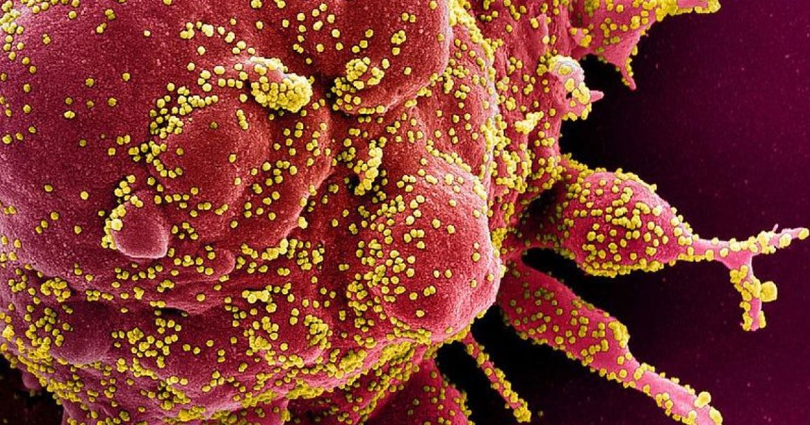 DARPA developed a new test for COVID-19 that can spot an infection within 24 hours, even earlier than people start spreading the coronavirus to others.