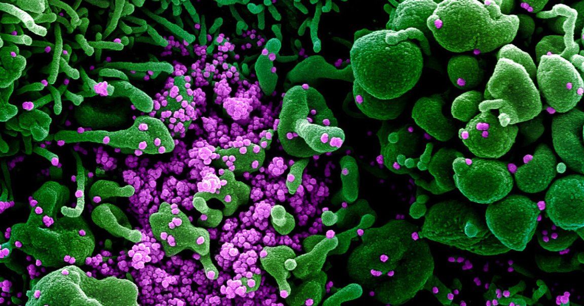 According to a new report, researchers outline a new dominant strain of coronavirus that appears to be more contagious than the previously dominating one.