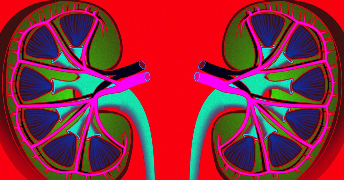 According to a new study, a large medical system located in New York, over a third of COVID-19 patients experienced acute kidney injury.