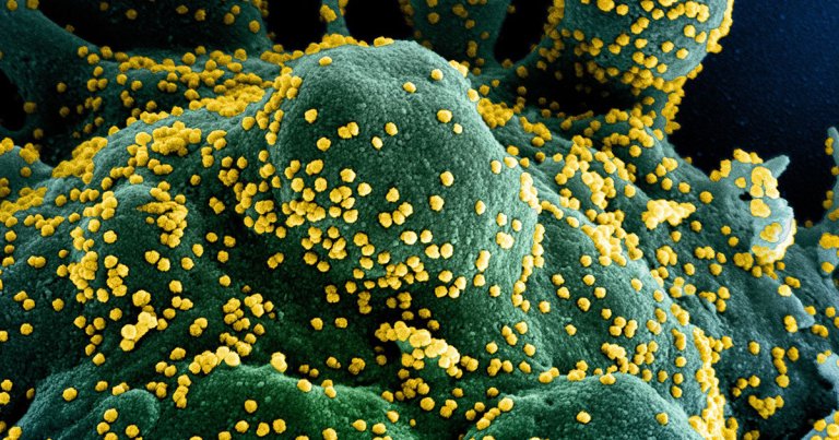 "This virus may become just another endemic virus in our communities, and this virus may never go away," WHO emergencies expert Mike Ryan said on Thursday.
