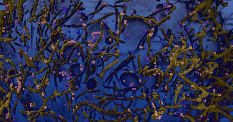 A common mutation of the coronavirus is far more contagious than others, potentially explaining why some regions were so devastated.