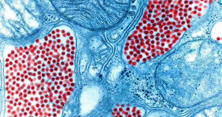 Eastern equine encephalitis (EEE) virus infections are on the rise in the Northeastern United States, in large part thanks to global warming.