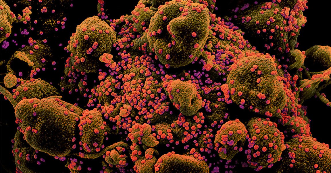 New research shows that, without lockdowns, the U.S. would have likely had nearly 5 million more cases of the coronavirus by early April.