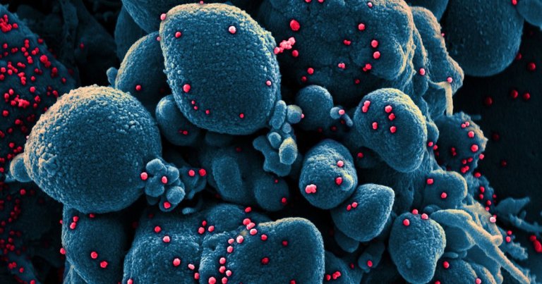 Multiple scientists have found that greater humidity seems to block the coronavirus from spreading, but experts warn against complacency if cases drop.