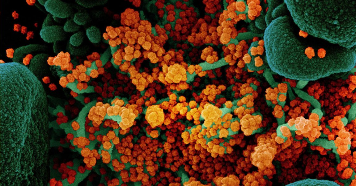 A team of German scientists are throwing a tightly-controlled concert in order to understand how COVID-19 can spread in large crowds.