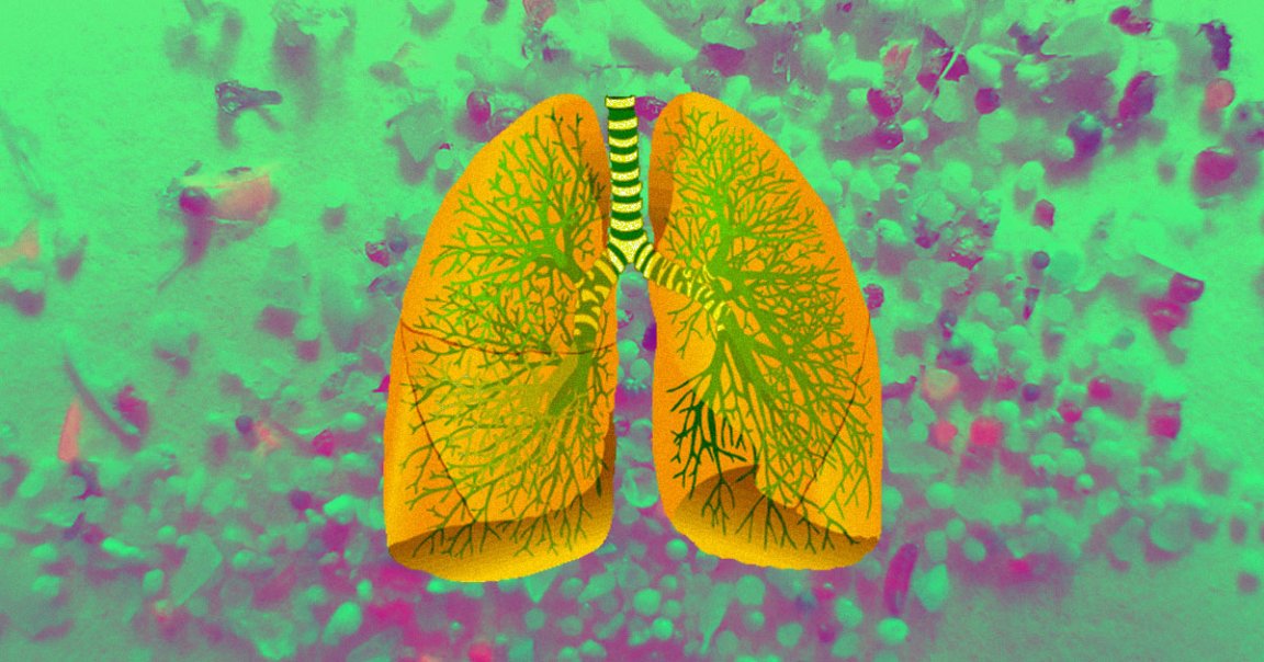 A team from Arizona State University found nanoplastic particles in all 47 examined human lungs, liver, spleen, and kidney samples.