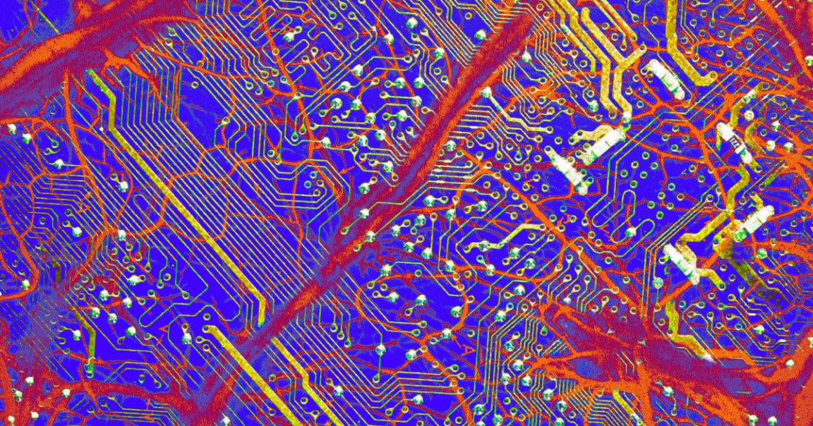 A new brain-computer interface doesn't actually touch the brain or require open-skull surgery. Rather, it snakes through the jugular vein and listens in.